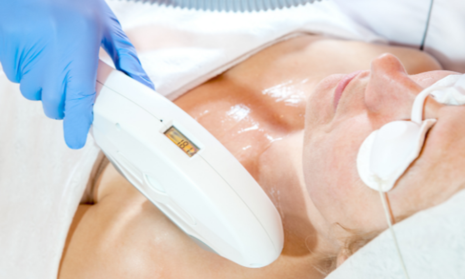 Laser treatment